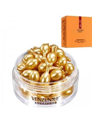 Venzen