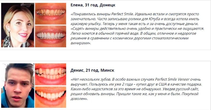 Перфект Смайл Виниры для зубов