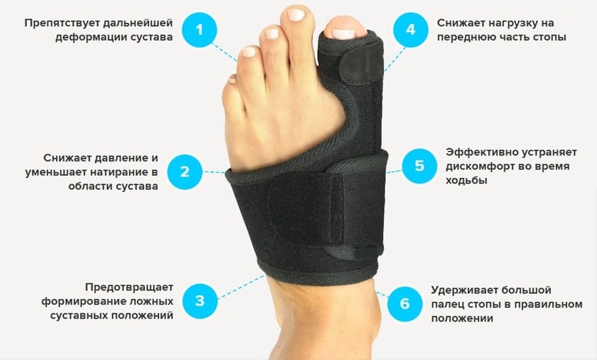 МагнетФикс вальгусная шина