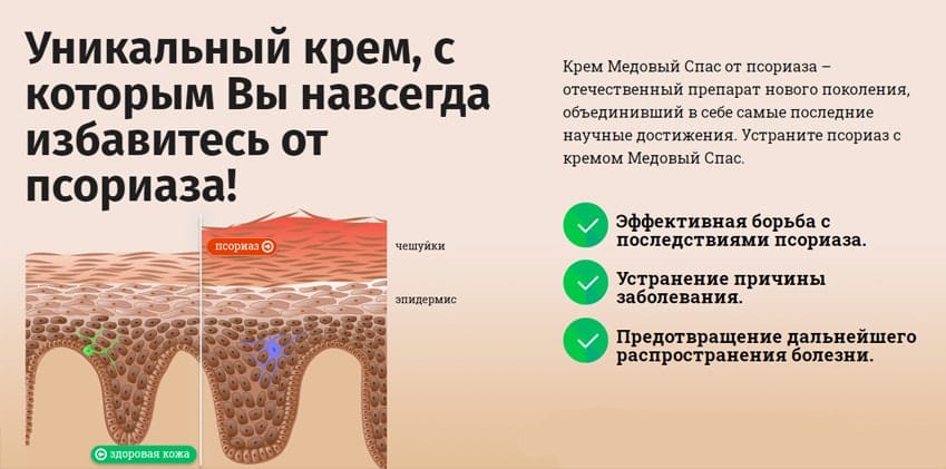 Медовый Спас от псориаза масло