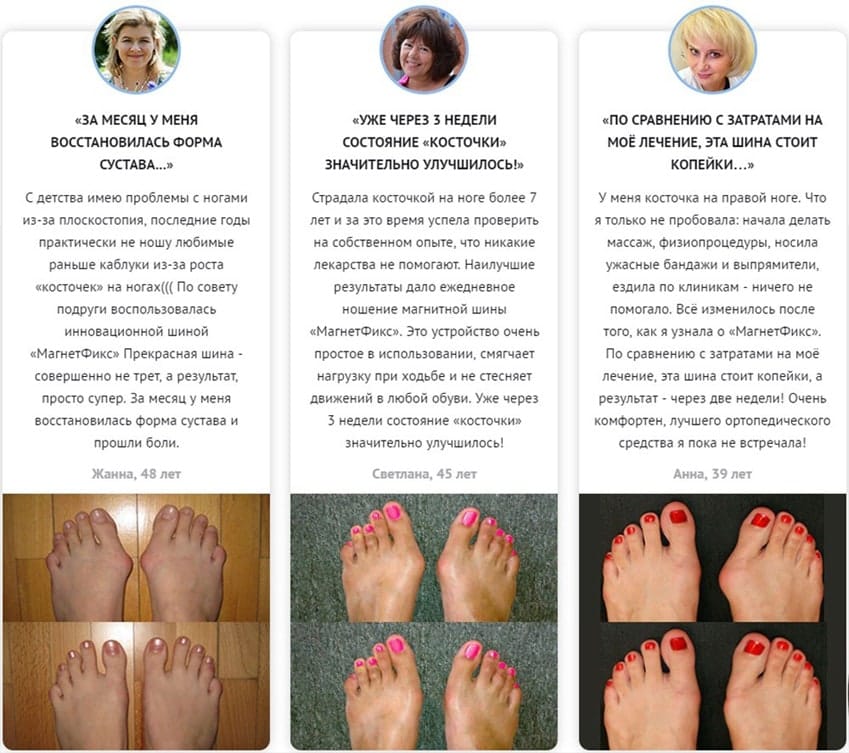 Valgus Pro фиксатор для большого пальца