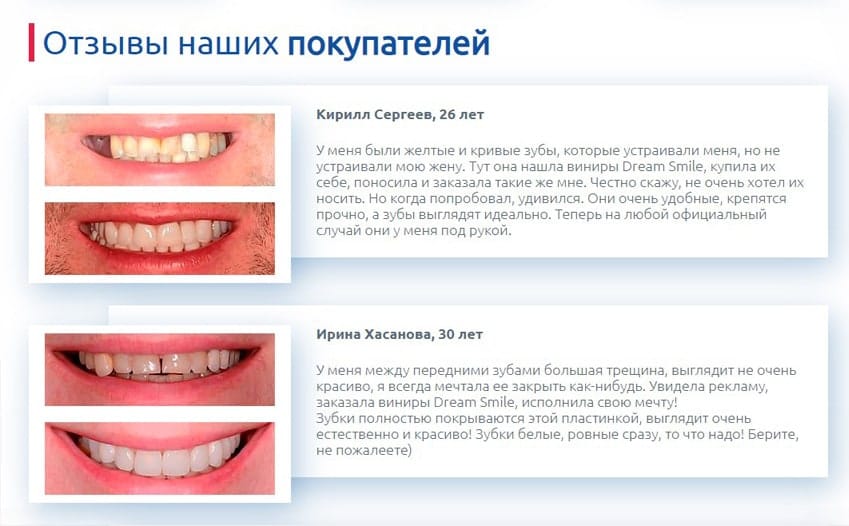 Дрим Смайл съемные виниры