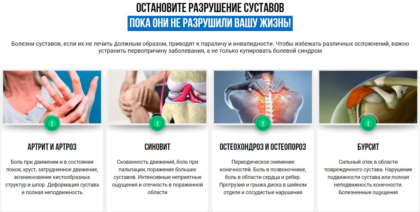 Артрозакс крем с дозатором, 30 мл
