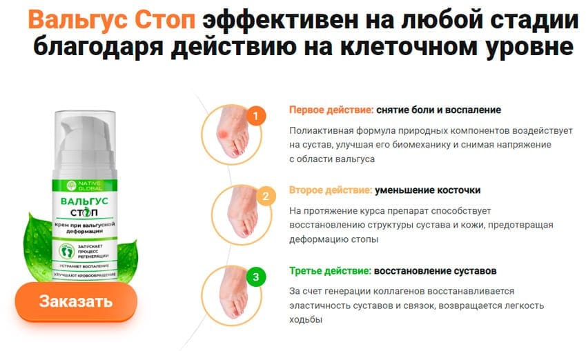 Крем Вальгус-Стоп при вальгусной деформации
