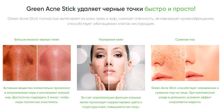 Green Acne Stick средство для очистки пор