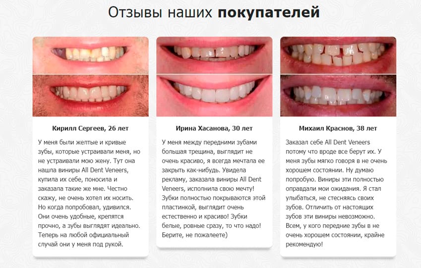 All Dent Veneers виниры