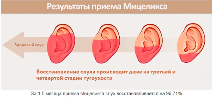 Мицеликс для слуха 
