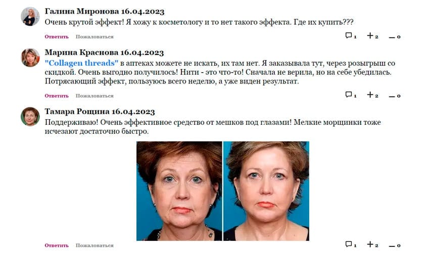 Коллаген Тредс коллагеновые нити