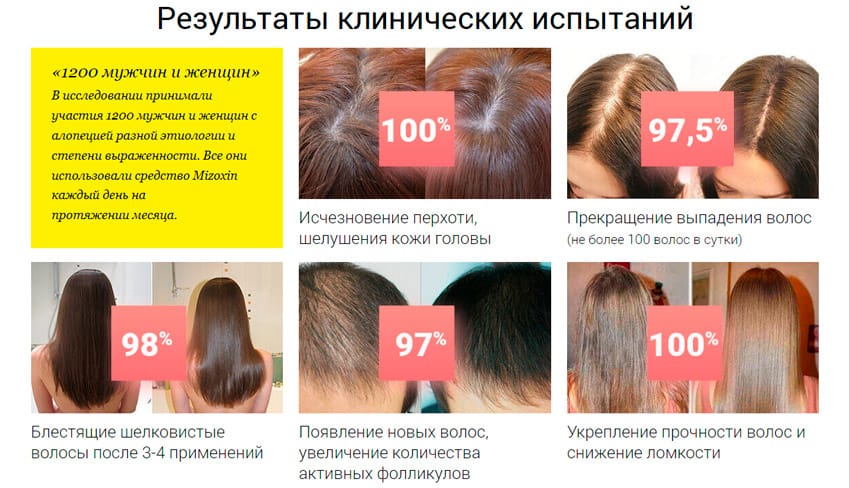 Mizoxin от выпадения волос
