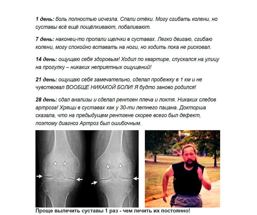 Артракс капсулы