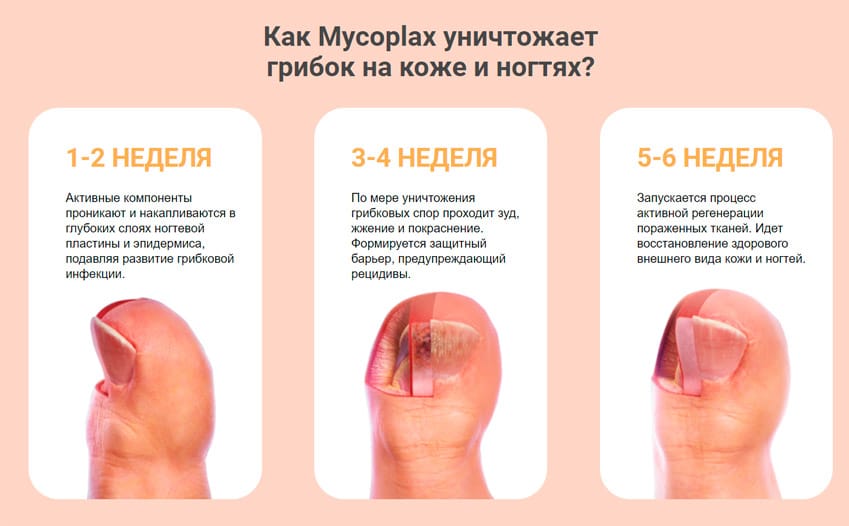 Mycoplax гель от грибка