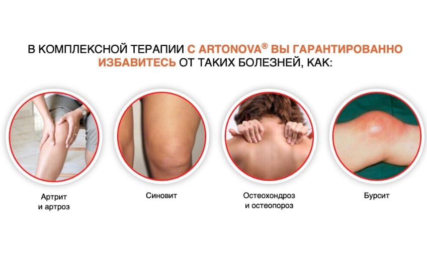 Артонова капсулы для суставов