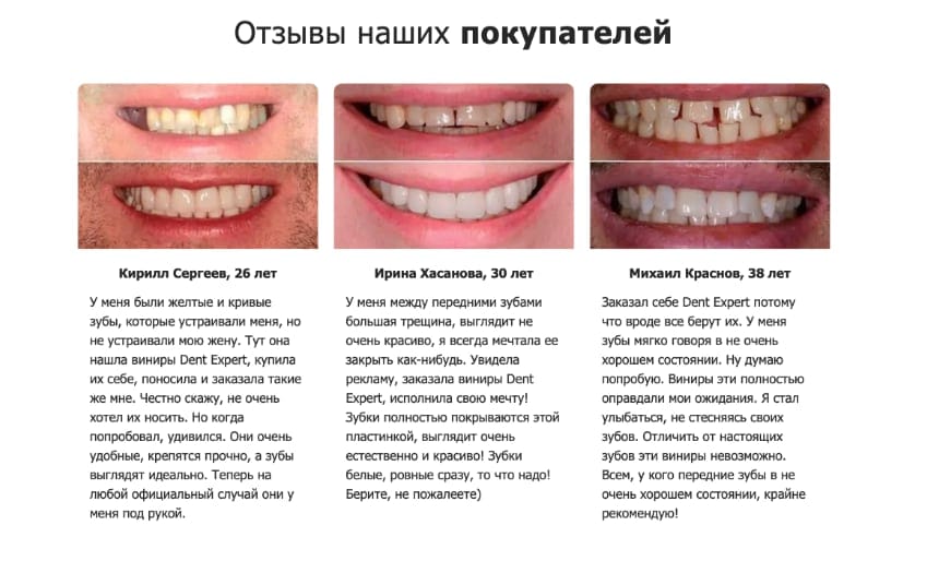Дент Эксперт виниры для зубов